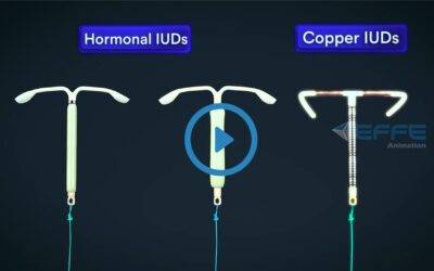 Portfolio: 3D Animation Video of Intrauterine Devices Demystifying (IUDs) : 3D Medical Animation Company